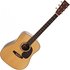 Martin HD-28E LR Baggs Anthem (2025) - Image 3